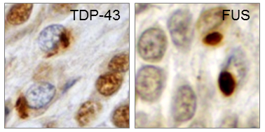 Fig.1 _TDP & FUS